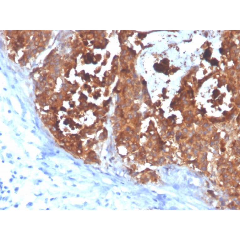 Immunohistochemistry - Anti-Carcinoembryonic Antigen Antibody [C66/4098] - BSA and Azide free (A251308) - Antibodies.com