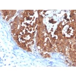 Immunohistochemistry - Anti-Carcinoembryonic Antigen Antibody [C66/4098] - BSA and Azide free (A251308) - Antibodies.com