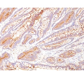 Immunohistochemistry - Anti-Carcinoembryonic Antigen Antibody [COL-1] - BSA and Azide free (A251308) - Antibodies.com
