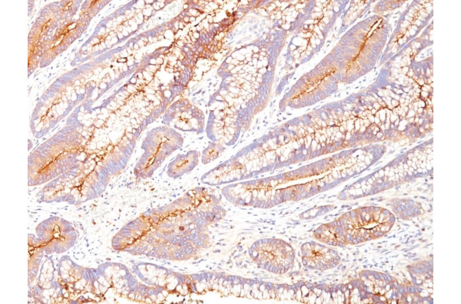 Immunohistochemistry - Anti-Carcinoembryonic Antigen Antibody [COL-1] - BSA and Azide free (A251308) - Antibodies.com
