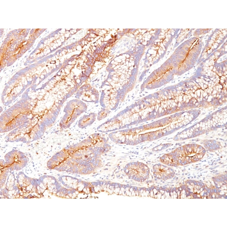 Immunohistochemistry - Anti-Carcinoembryonic Antigen Antibody [COL-1] - BSA and Azide free (A251308) - Antibodies.com