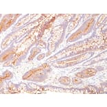 Immunohistochemistry - Anti-Carcinoembryonic Antigen Antibody [COL-1] - BSA and Azide free (A251308) - Antibodies.com