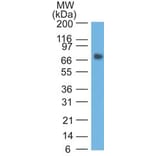 Western Blot - Anti-Carcinoembryonic Antigen Antibody [COL-1] - BSA and Azide free (A251309) - Antibodies.com