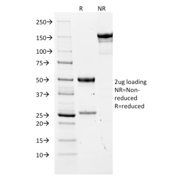 SDS-PAGE - Anti-Carcinoembryonic Antigen Antibody [COL-1] - BSA and Azide free (A251309) - Antibodies.com