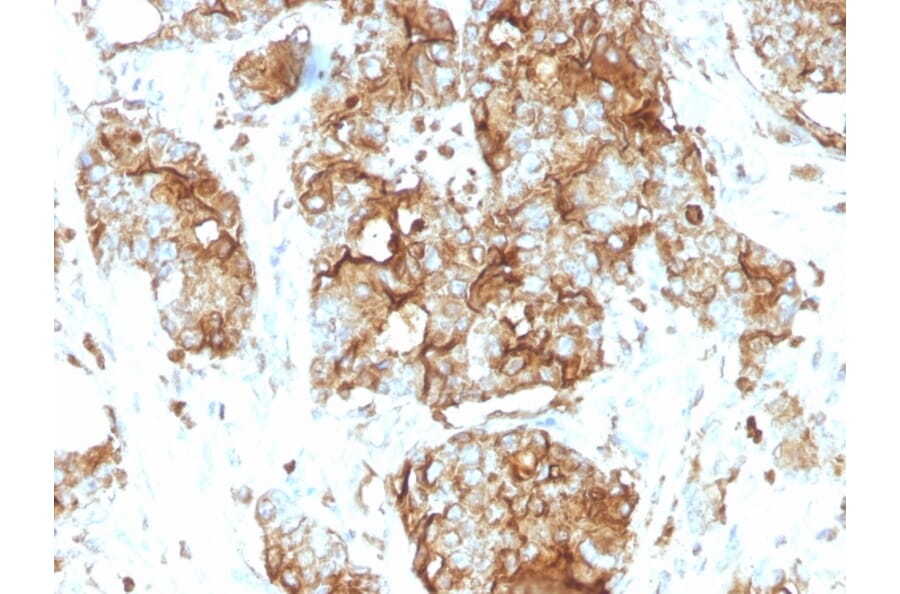 Immunohistochemistry - Anti-Carcinoembryonic Antigen Antibody [SPM584] - BSA and Azide free (A251309) - Antibodies.com