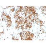 Immunohistochemistry - Anti-Carcinoembryonic Antigen Antibody [SPM584] - BSA and Azide free (A251309) - Antibodies.com