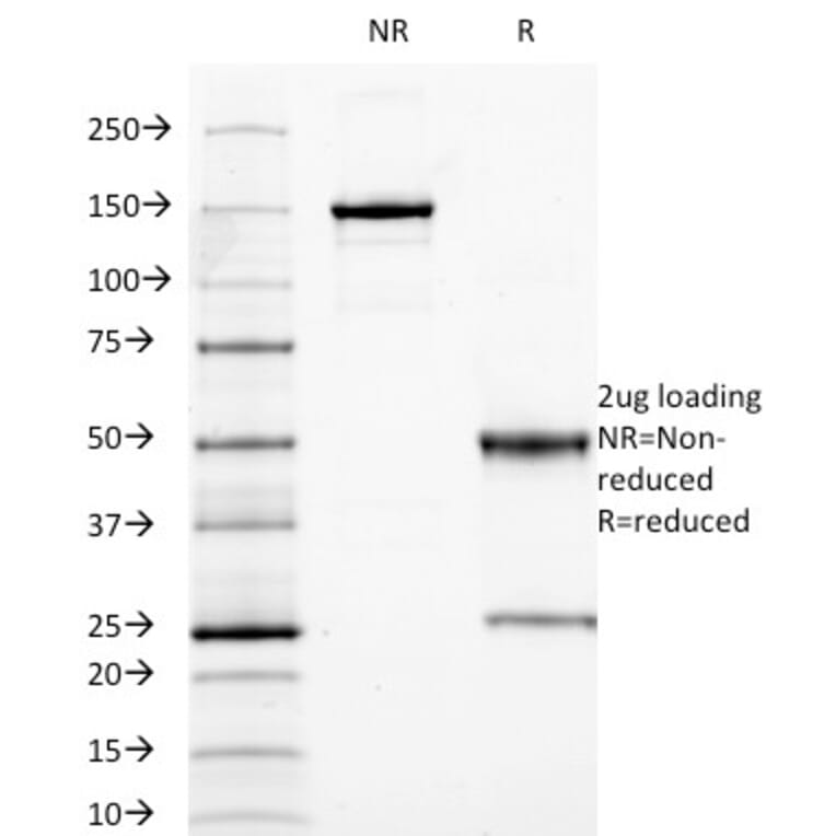 SDS-PAGE - Anti-Carcinoembryonic Antigen Antibody [SPM584] - BSA and Azide free (A251310) - Antibodies.com