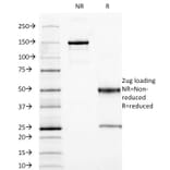 SDS-PAGE - Anti-Carcinoembryonic Antigen Antibody [SPM584] - BSA and Azide free (A251310) - Antibodies.com