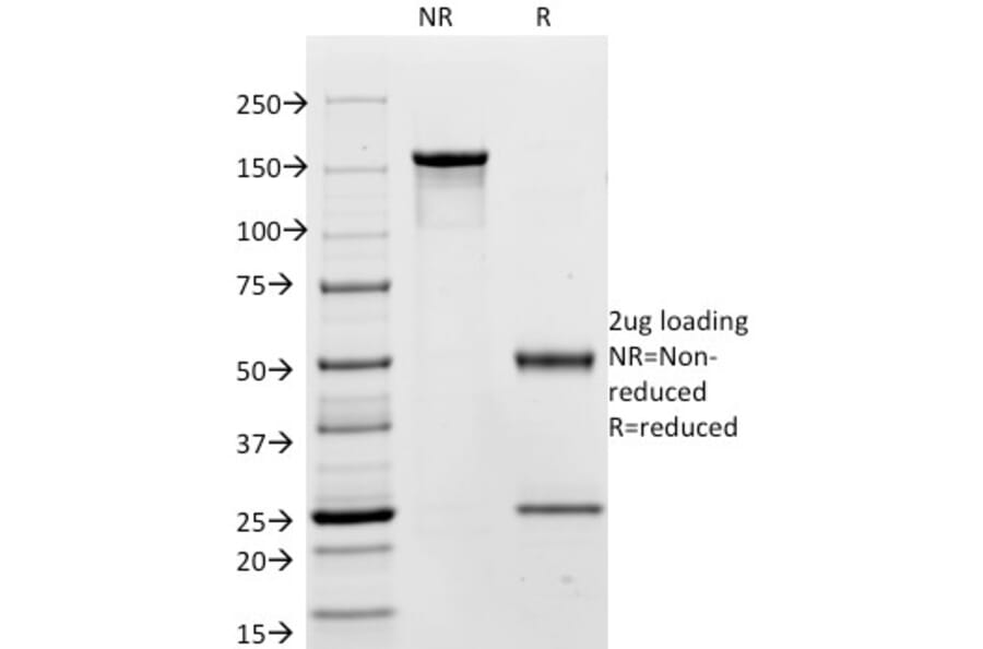 SDS-PAGE - Anti-Carcinoembryonic Antigen Antibody [C66/195] - BSA and Azide free (A251311) - Antibodies.com