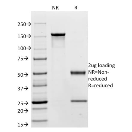 SDS-PAGE - Anti-Carcinoembryonic Antigen Antibody [C66/195] - BSA and Azide free (A251311) - Antibodies.com
