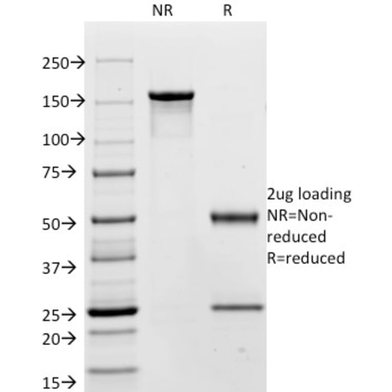 SDS-PAGE - Anti-Carcinoembryonic Antigen Antibody [C66/195] - BSA and Azide free (A251311) - Antibodies.com