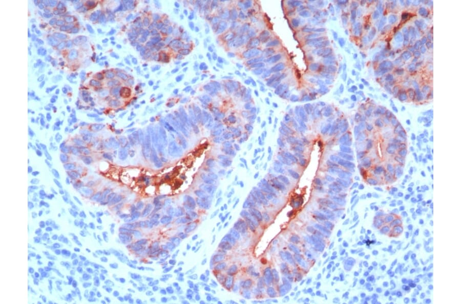 Immunohistochemistry - Anti-Carcinoembryonic Antigen Antibody [C66/195] - BSA and Azide free (A251310) - Antibodies.com