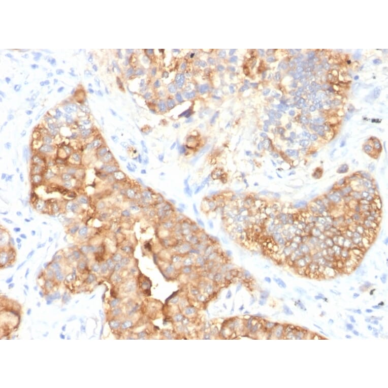 Immunohistochemistry - Anti-Carcinoembryonic Antigen Antibody [SPM330] - BSA and Azide free (A251311) - Antibodies.com