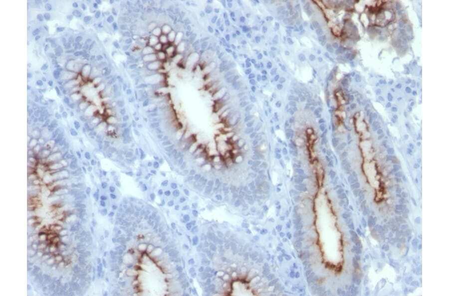 Immunohistochemistry - Anti-Carcinoembryonic Antigen Antibody [C66/261] - BSA and Azide free (A251313) - Antibodies.com