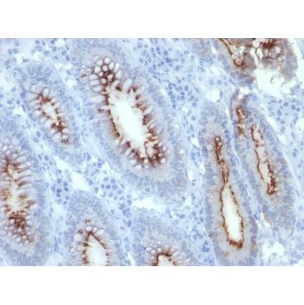 Immunohistochemistry - Anti-Carcinoembryonic Antigen Antibody [C66/261] - BSA and Azide free (A251313) - Antibodies.com