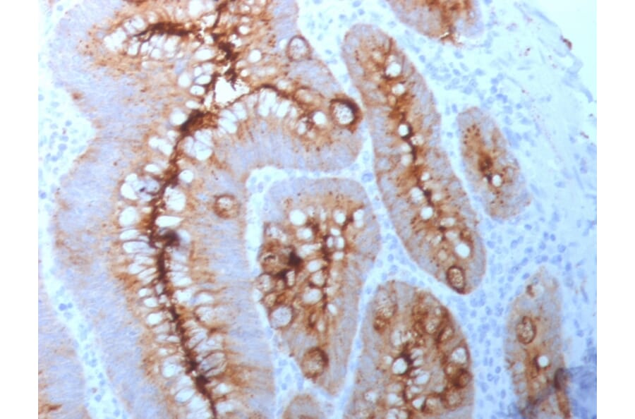 Immunohistochemistry - Anti-Carcinoembryonic Antigen Antibody [C66/261] - BSA and Azide free (A251312) - Antibodies.com