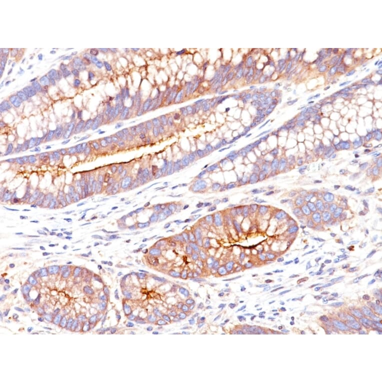 Immunohistochemistry - Anti-Carcinoembryonic Antigen Antibody [SPM551] - BSA and Azide free (A251313) - Antibodies.com