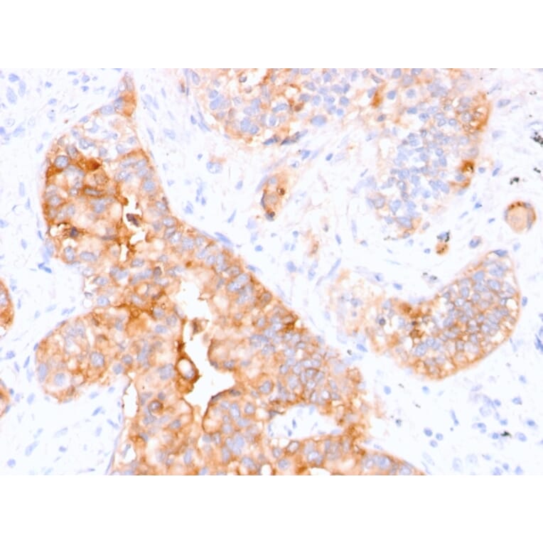 Immunohistochemistry - Anti-Carcinoembryonic Antigen Antibody [CEA31] - BSA and Azide free (A251315) - Antibodies.com