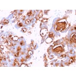 Immunohistochemistry - Anti-Carcinoembryonic Antigen Antibody [CEA31] - BSA and Azide free (A251315) - Antibodies.com