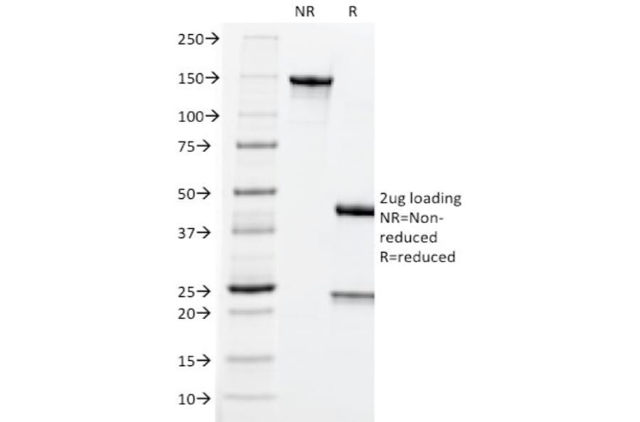 SDS-PAGE - Anti-Carcinoembryonic Antigen Antibody [CEA31] - BSA and Azide free (A251315) - Antibodies.com