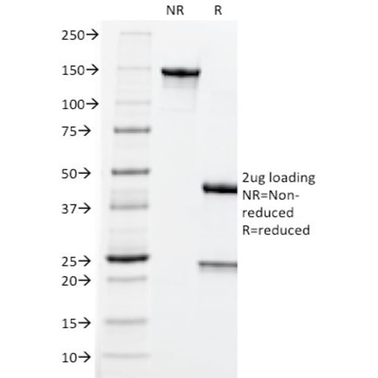SDS-PAGE - Anti-Carcinoembryonic Antigen Antibody [CEA31] - BSA and Azide free (A251315) - Antibodies.com