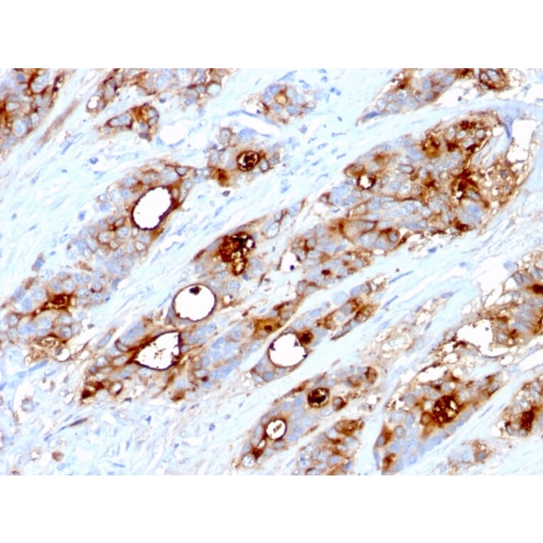 Immunohistochemistry - Anti-Carcinoembryonic Antigen Antibody [CEA31] - BSA and Azide free (A251314) - Antibodies.com