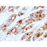 Immunohistochemistry - Anti-Carcinoembryonic Antigen Antibody [CEA31] - BSA and Azide free (A251314) - Antibodies.com