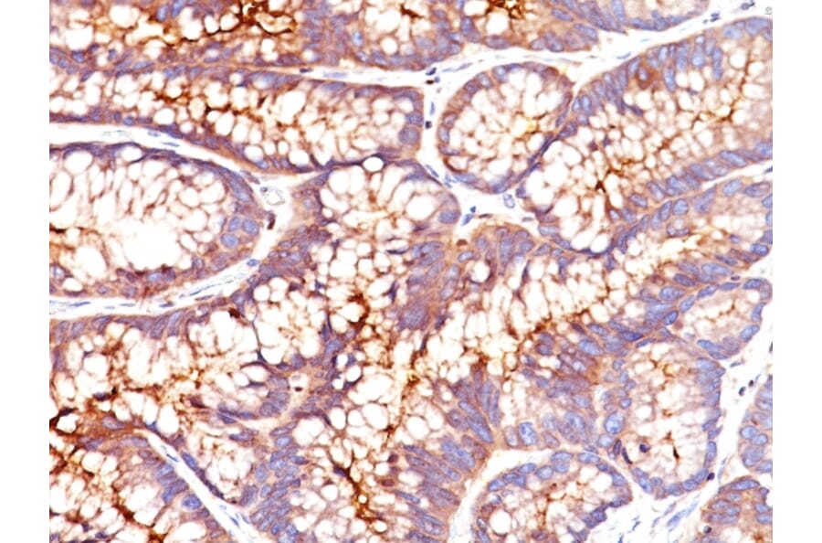 Immunohistochemistry - Anti-Carcinoembryonic Antigen Antibody [SPM541] - BSA and Azide free (A251315) - Antibodies.com