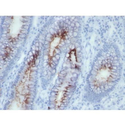Immunohistochemistry - Anti-Carcinoembryonic Antigen Antibody [SPM506] - BSA and Azide free (A251316) - Antibodies.com