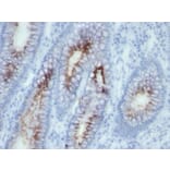 Immunohistochemistry - Anti-Carcinoembryonic Antigen Antibody [SPM506] - BSA and Azide free (A251316) - Antibodies.com