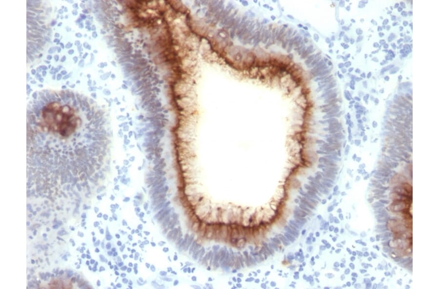 Immunohistochemistry - Anti-Carcinoembryonic Antigen Antibody [C66/1009] - BSA and Azide free (A251317) - Antibodies.com