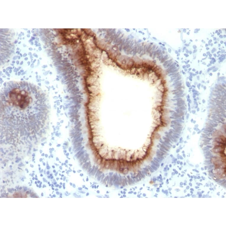 Immunohistochemistry - Anti-Carcinoembryonic Antigen Antibody [C66/1009] - BSA and Azide free (A251317) - Antibodies.com