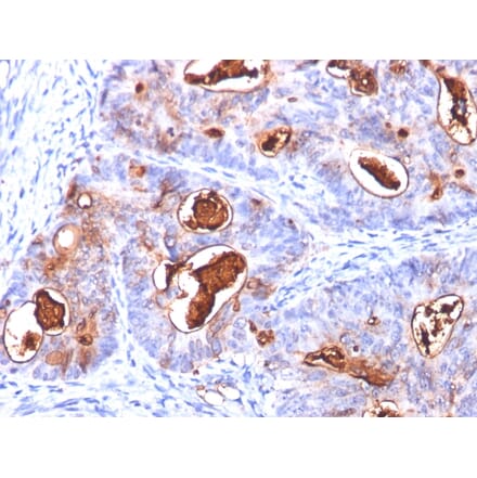 Immunohistochemistry - Anti-Carcinoembryonic Antigen Antibody [COL-1 + CEA31 + C66/261] - BSA and Azide free (A251318) - Antibodies.com
