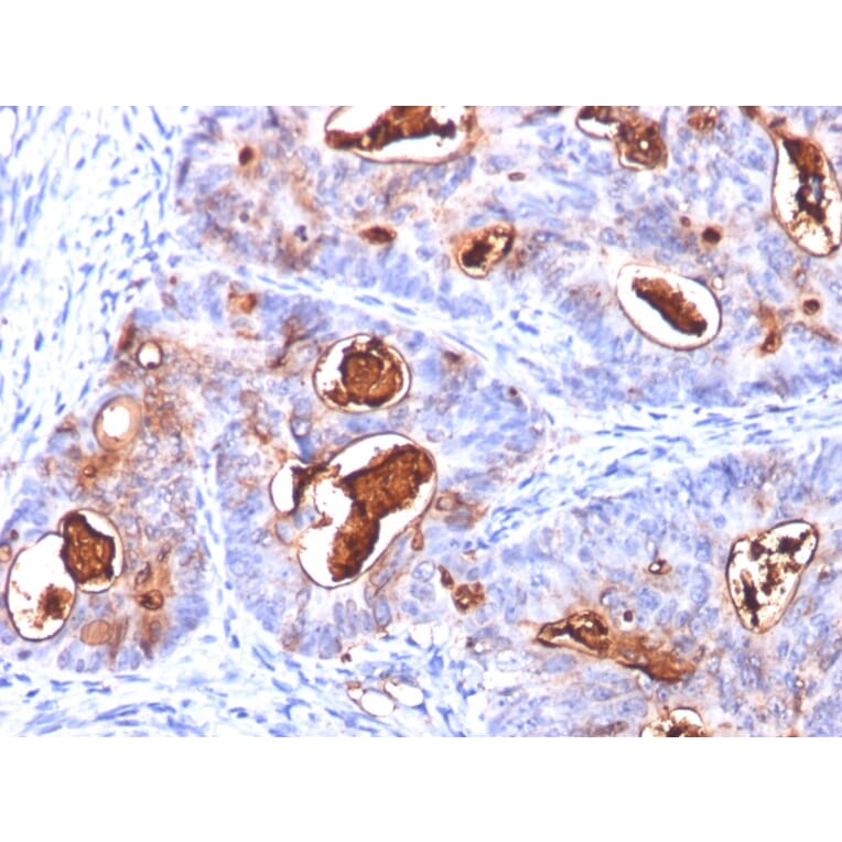 Immunohistochemistry - Anti-Carcinoembryonic Antigen Antibody [COL-1 + CEA31 + C66/261] - BSA and Azide free (A251318) - Antibodies.com