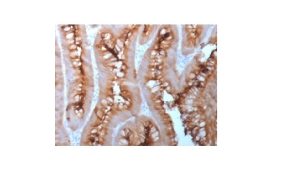 Immunohistochemistry - Anti-Carcinoembryonic Antigen Antibody [C66/1983R] - BSA and Azide free (A251321) - Antibodies.com