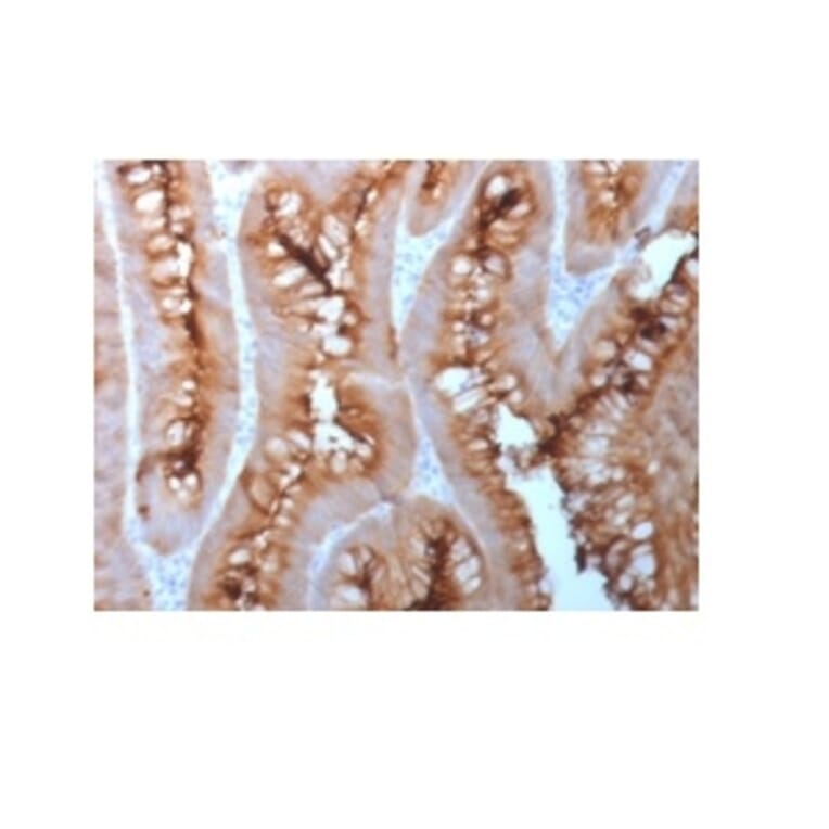 Immunohistochemistry - Anti-Carcinoembryonic Antigen Antibody [C66/1983R] - BSA and Azide free (A251321) - Antibodies.com