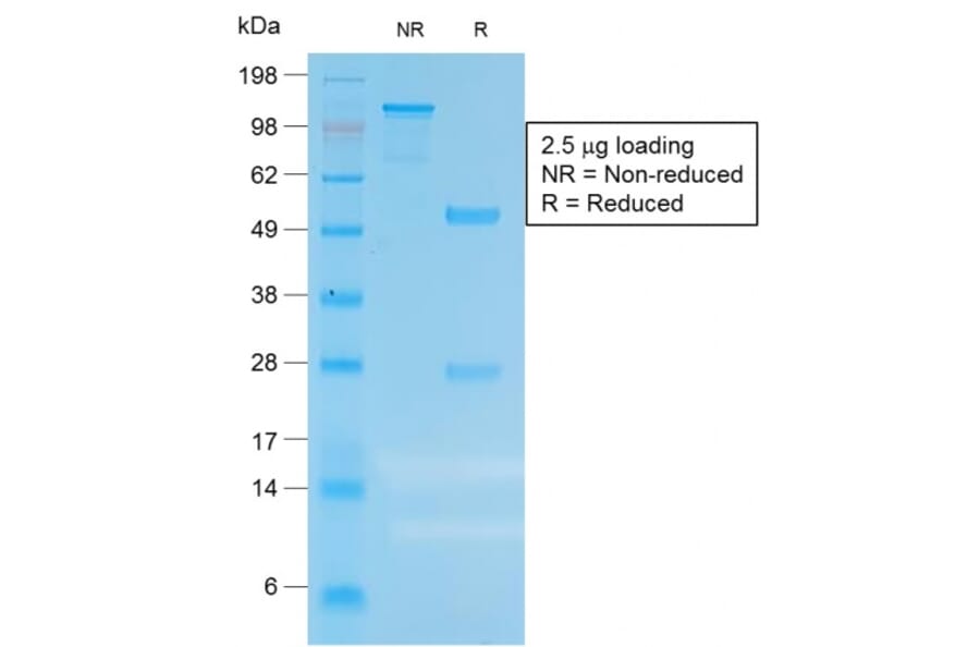 SDS-PAGE - Anti-Carcinoembryonic Antigen Antibody [C66/1983R] - BSA and Azide free (A251322) - Antibodies.com