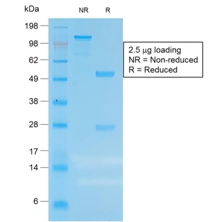 SDS-PAGE - Anti-Carcinoembryonic Antigen Antibody [C66/1983R] - BSA and Azide free (A251322) - Antibodies.com