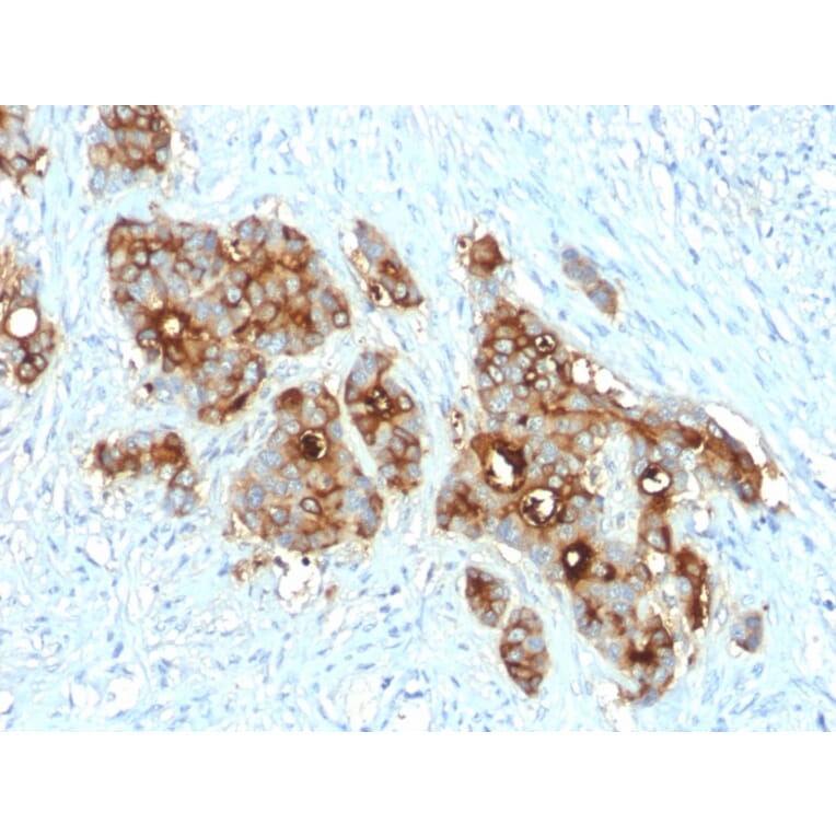 Immunohistochemistry - Anti-Carcinoembryonic Antigen Antibody [C66/2055R] - BSA and Azide free (A251322) - Antibodies.com
