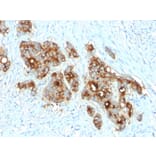 Immunohistochemistry - Anti-Carcinoembryonic Antigen Antibody [C66/2055R] - BSA and Azide free (A251322) - Antibodies.com