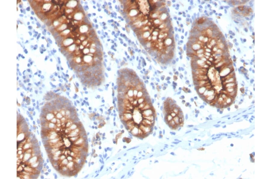 Immunohistochemistry - Anti-Carcinoembryonic Antigen Antibody [C66/3707R] - BSA and Azide free (A251324) - Antibodies.com