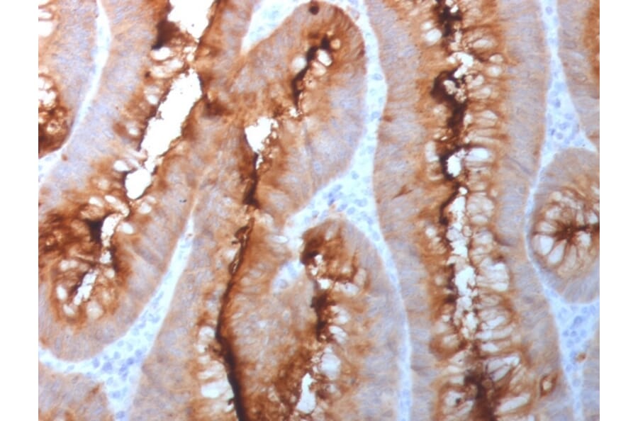Immunohistochemistry - Anti-Carcinoembryonic Antigen Antibody - BSA and Azide free (A251324) - Antibodies.com