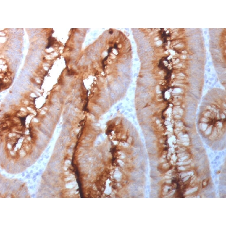 Immunohistochemistry - Anti-Carcinoembryonic Antigen Antibody - BSA and Azide free (A251324) - Antibodies.com