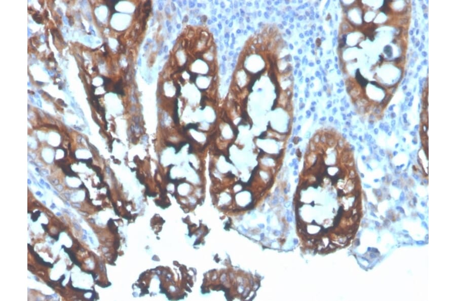 Immunohistochemistry - Anti-Carcinoembryonic Antigen Antibody - BSA and Azide free (A251325) - Antibodies.com