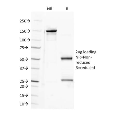 SDS-PAGE - Anti-Semaphorin 4D Antibody [A8] - BSA and Azide free (A251326) - Antibodies.com