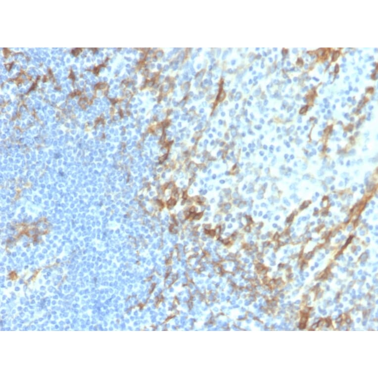 Immunohistochemistry - Anti-Podocalyxin Antibody [PDPN/4009R] - BSA and Azide free (A251332) - Antibodies.com