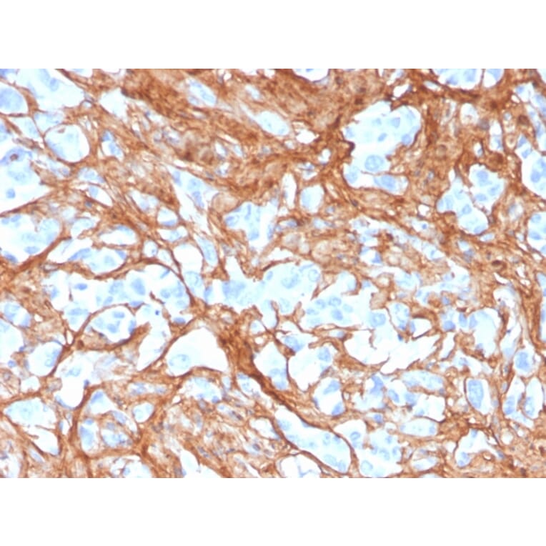 Immunohistochemistry - Anti-Periostin Antibody [POSTN/3501] - BSA and Azide free (A251333) - Antibodies.com