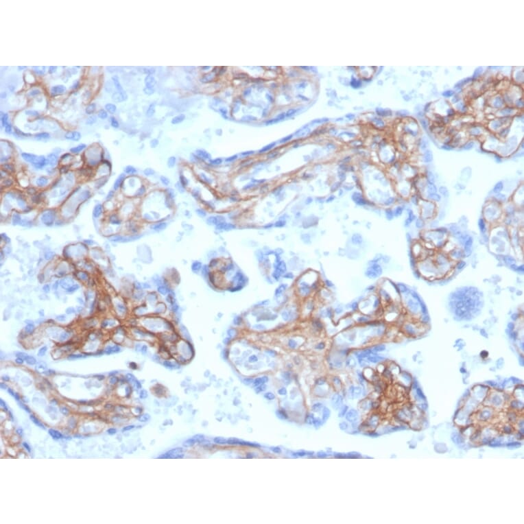 Immunohistochemistry - Anti-Periostin Antibody [POSTN/3503] - BSA and Azide free (A251334) - Antibodies.com