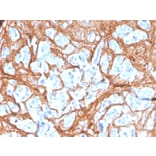 Immunohistochemistry - Anti-Periostin Antibody [POSTN/3503] - BSA and Azide free (A251334) - Antibodies.com