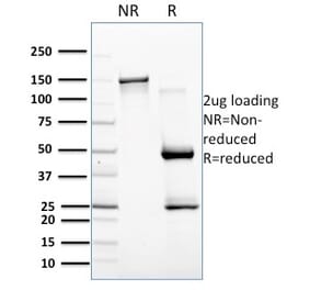 SDS-PAGE - Anti-BAFF Antibody [C257/1638] - BSA and Azide free (A251334) - Antibodies.com